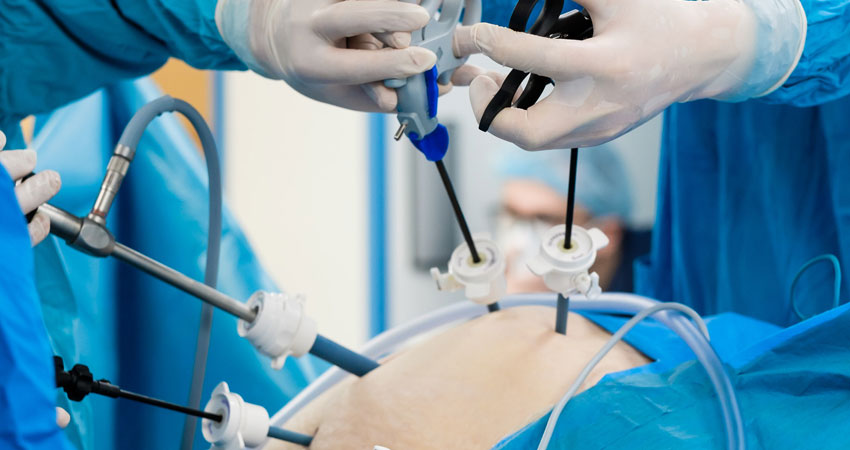 Gynae Laparoscopic Surgery