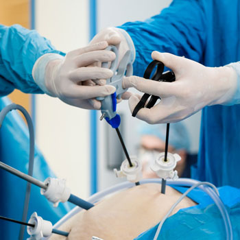 Gynae Laparoscopic Surgery